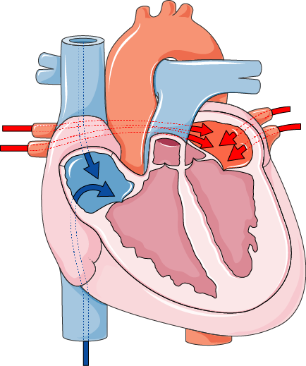 Blood coming from Body and Lungs