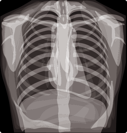 diagnosis and treatment of heart failure